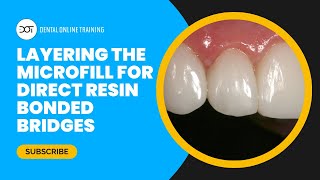 Layering the Microfill for Direct Resin Bonded Bridge with Dr Dennis Hartlieb  DOT Course Clip [upl. by Thoer]