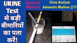 Urine Test By Dipstick and Urine Analyser  UTI infectionDiabetes MellitusJaundice etc [upl. by Eram327]