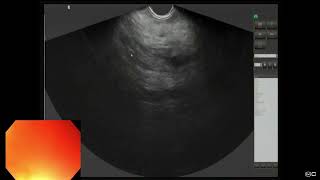 DHC Endoscopic Camera Images [upl. by Nnalyrehc]