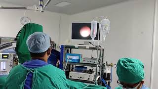 Laser Kidney Stone Surgeon in Pune  ESWL Surgery  Dr Irfan Shaikh  Urolife Clinic Pune [upl. by Anelrad]