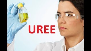 Urée urée élevée et urée basse [upl. by Byrle]