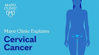 Mayo Clinic Explains Cervical Cancer [upl. by Keil439]