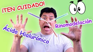 Acido Hialurónico en Rinomodelación [upl. by Nonrev907]