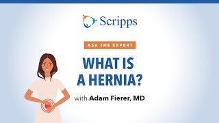 Causes Symptoms and Treatment for Hernias  Ask The Expert [upl. by Benedic]