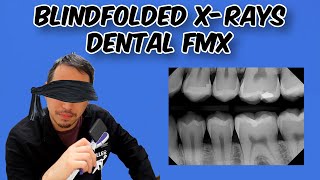 Blindfolded Dental XRays  Dental Challenge [upl. by Ymrej708]