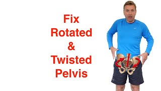 Best Rotated Pelvis Correction Exercises [upl. by Dnalyk]