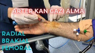 ARTER KAN GAZI NASIL ALINIR RADİAL ARTERBRAKİAL ARTERFEMORAL ARTER KAN GAZI ALMA PRATİĞİ [upl. by Ynabla]