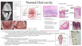 Pathology Made EasySystemic Pathology 15Head amp Neck Diseases2Oral cavity diseases1 [upl. by Kirch]