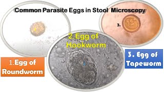 Roundworm Tapeworm and Hookworm eggs in Stool Microscopy [upl. by Fugere]