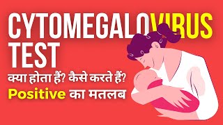 Cytomegalovirus IgG Test in Hindi  CMV IgG Test Positive क्या होता है [upl. by Peonir]