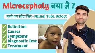 Microcephaly in Hindi  Causes Symptoms And Treatment of Microcephaly [upl. by Twyla]