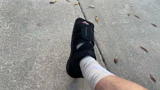 2  1 Day PostSurgery  Cheilectomy Surgery  Patient Recovery amp Review Hallux Rigidus Big Toe [upl. by Bremer]