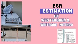 Erythrocyte sedimentation rate ESR [upl. by Krusche608]