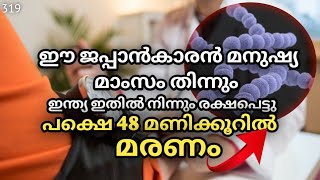 30വയസ്സിനു മേലെ ഉള്ളവർ സൂക്ഷിക്കുക 😳😳FLESH EATING BACTERIA JAPAN MALAYALAM TALKSOFKITCHEES [upl. by Eniar727]