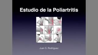 Poliartritis Estudio Diagnóstico [upl. by Denison]