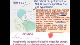 THE NEW NURSE  HYPOTHERMIA [upl. by Titus]