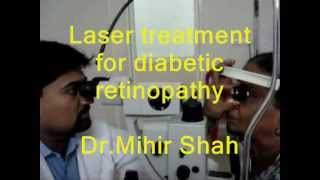 Laser treatment for diabetic retinopathy of eye done by DrMihir Shah at Kozhikode Kerala [upl. by Ahsinev]