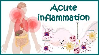 Acute Inflammation  symptoms Pathogenesis Cause of inflammation Mediators of Acute Inflammation [upl. by Taggart]