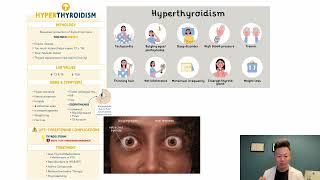 Hyperthyroid vs Hypothyroid [upl. by Longawa691]