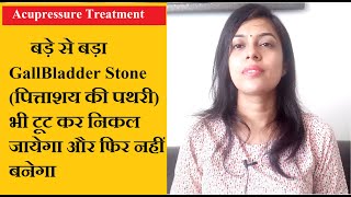 Acupressure points for gallbladder stones  Gallbladder stone ka ilaj in hindi [upl. by Asenaj]