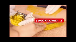 VÜCUT KILLARINDAN SONSUZA KADAR KURTUL 🖐🏻 JİLET VEYA AĞDAYI UNUT  PEKi NASIL  👇🏻 [upl. by Asin387]