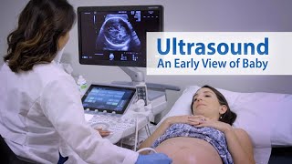 ULTRASOUND An Early View of Baby [upl. by Akemej235]