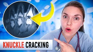 Arthritis Doctor Explains CRACKING KNUCKLES GOOD or BAD [upl. by Mcclish917]