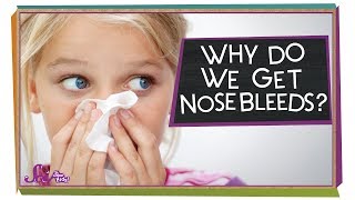 What are the common causes of nosebleeds in children  Dr Kumaresh Krishnamoorthy [upl. by Yehsa]