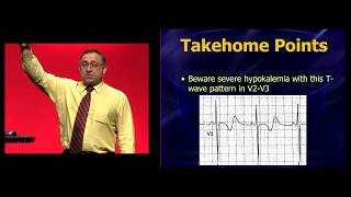 EEM 2019 Hypokalemia You thought you knew how to recognize it [upl. by Manus]