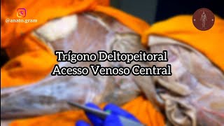 Anatomia do trígono deltopeitoral veia cefálica acesso venoso central infraclavicular [upl. by Benedetto420]