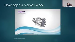 Zephyr Endobronchial Valves A treatment to reduce hyperinflation in patients with severe emphysema [upl. by Bonni]