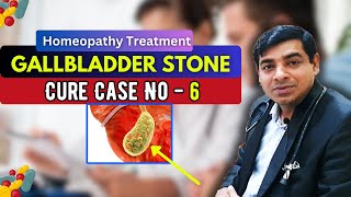 Gallbladder Stone Case No 6  Homeopathy Treatment for Gallbladder Stone  Dr Abhik Ghosh Homeopathy [upl. by Albur]