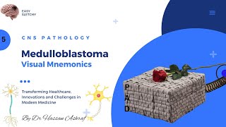 Medulloblastoma Pathology  Visual Mnemonics  Morphology  CNS Pathology  NEET PG USMLE MBBS [upl. by Nnailuj]