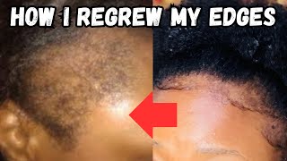 REGROW YOUR EDGES AND BALDSPOTS IN 7 DAYS  The Natural Way ✨ [upl. by Harim77]