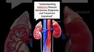 About Addisons disease health addisonsdisease disease kidney [upl. by Ardyce]