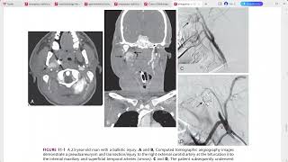 EMERGENCY RADIOLOGY REQUISITES [upl. by Nodanrb]