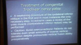 Trochlear Nerve Palsy [upl. by Axel496]