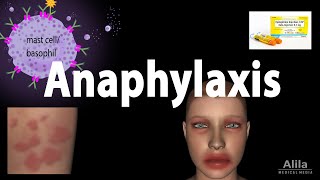 Anaphylaxis Animation [upl. by Laurie292]