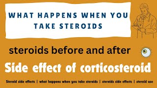 Steroid side effects  what happens when you take steroids  steroids side effects  steroid use [upl. by Aroled]