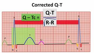 WHAT DO YOU KNOW ABOUT QTc INTERVAL quotNORMAL ECG VALUESquot  NARCOSIS😴🤤 [upl. by Bogey]