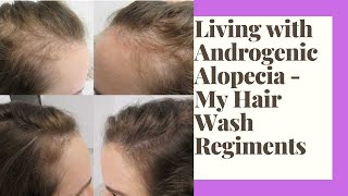 Living with Androgenic Alopecia  My Hair Wash Regimens [upl. by Yleek474]