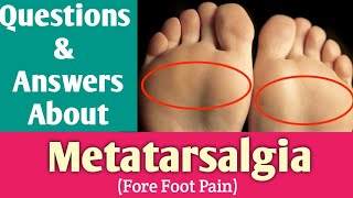 Questions amp answers about metatarsalgia  Forefoot pain  per ke panje ka dard [upl. by Einniw]