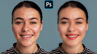 Face Retouching  Best Photoshop Tutorial  Skin Retouching [upl. by Trebma]