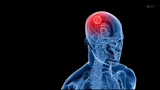 Unlocking Glioblastoma Treatment anticancer drug conjugate kills glioblastoma cells [upl. by Mannos1]