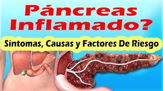 SINTOMAS DE PANCREATITIS AGUDA Y CRONICA Sintomas Del Pancreas Inflamado y Sus Causas [upl. by Onitsoga]