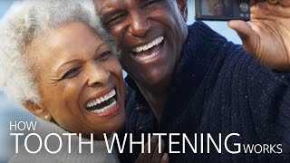 How Tooth Whitening Works [upl. by Worthy]