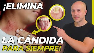 ¡ATENCIÓN GUÍA COMPLETA PARA ENTENDER Y ELIMINAR LA CÁNDIDA DE TU CUERPO  SIGNOS DE CÁNDIDA [upl. by Murphy]