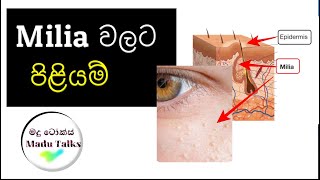 MILIA වලට පිළියම්  විශාල සහ කුඩා milia ඉවත් කල යුතු නිවැරිදි පිළිවෙල madutalks [upl. by Aciraa]