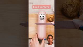 🏥💊 Doctor 💊🏥 food 💊 surgery  part 5  foodsurgery greenscreen doctor shorts viralvideo 05 [upl. by Matthia576]