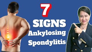 7 Signs of Ankylosing Spondylitis  A Rheumatologist Review [upl. by Aridatha]